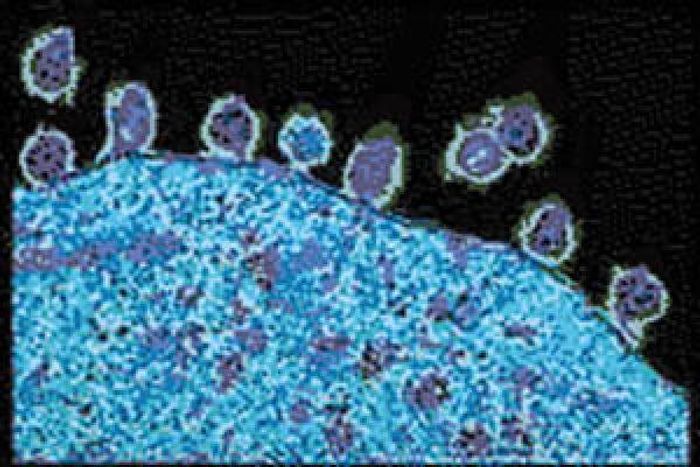 This image shows new HIV particles exiting an infected T-cell. / Credit: National Institutes of Health