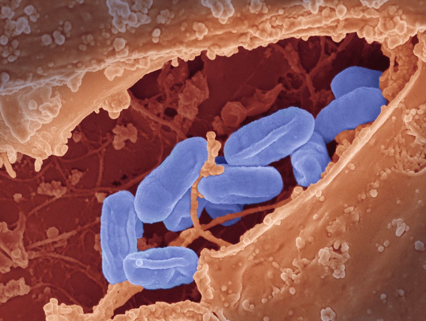 Scanning electron micrograph of Rickettsia typhi bacteria. Image captured at NIAID's Rocky Mountain Laboratories (RML) in Hamilton, Montana. Credit: NIAID