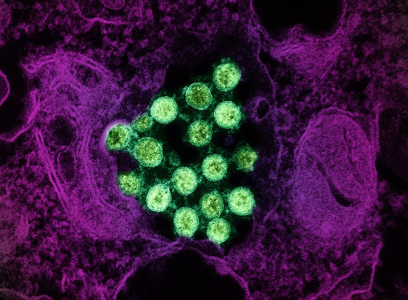 Transmission electron micrograph of SARS-CoV-2 virus particles (colorized green), isolated from a patient sample. Image captured at the NIAID Integrated Research Facility (IRF) in Fort Detrick, Maryland. Credit: NIAID