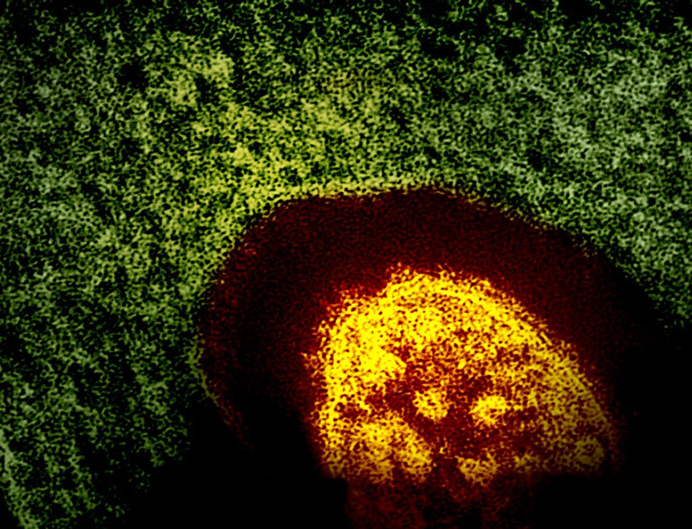 Colorized transmission electron micrograph of a measles virus particle (yellow and red). Microscopy is courtesy CDC; layout, colorization, and visual effects by NIAID. Credit: CDC and NIAID 