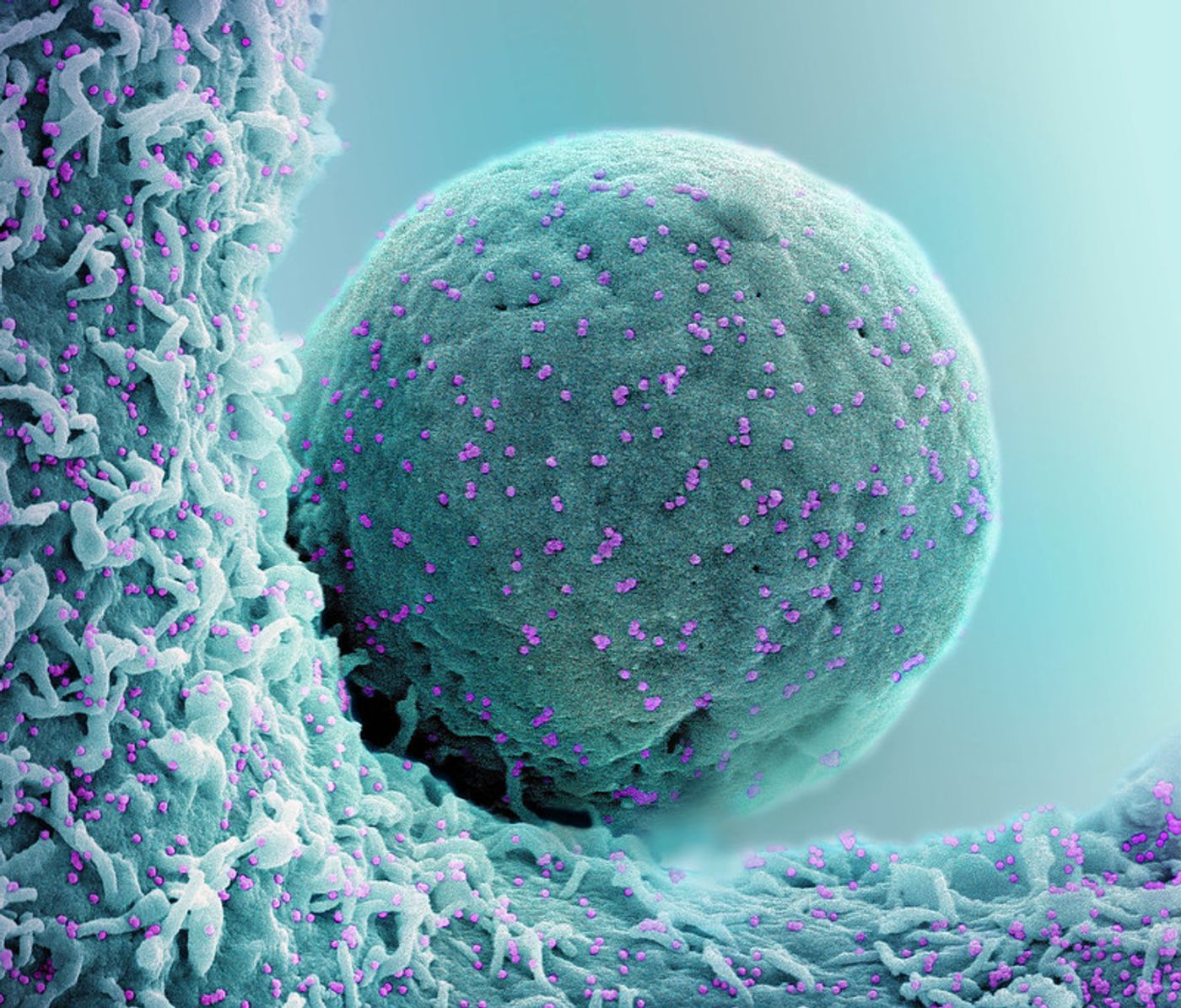 Colorized scanning electron micrograph of a cell (teal) infected with the Omicron strain of SARS-CoV-2 virus particles (purple), isolated from a patient sample. Image captured at the NIAID Integrated Research Facility (IRF) in Fort Detrick, Maryland. Credit: NIAID
