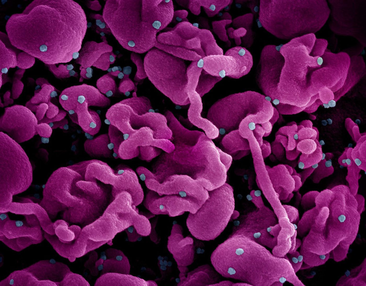Colorized scanning electron micrograph of a cell (pink) infected with the Omicron strain of SARS-CoV-2 virus particles (blue), isolated from a patient sample. Image captured at the NIAID Integrated Research Facility (IRF) in Fort Detrick, Maryland. Credit: NIAID