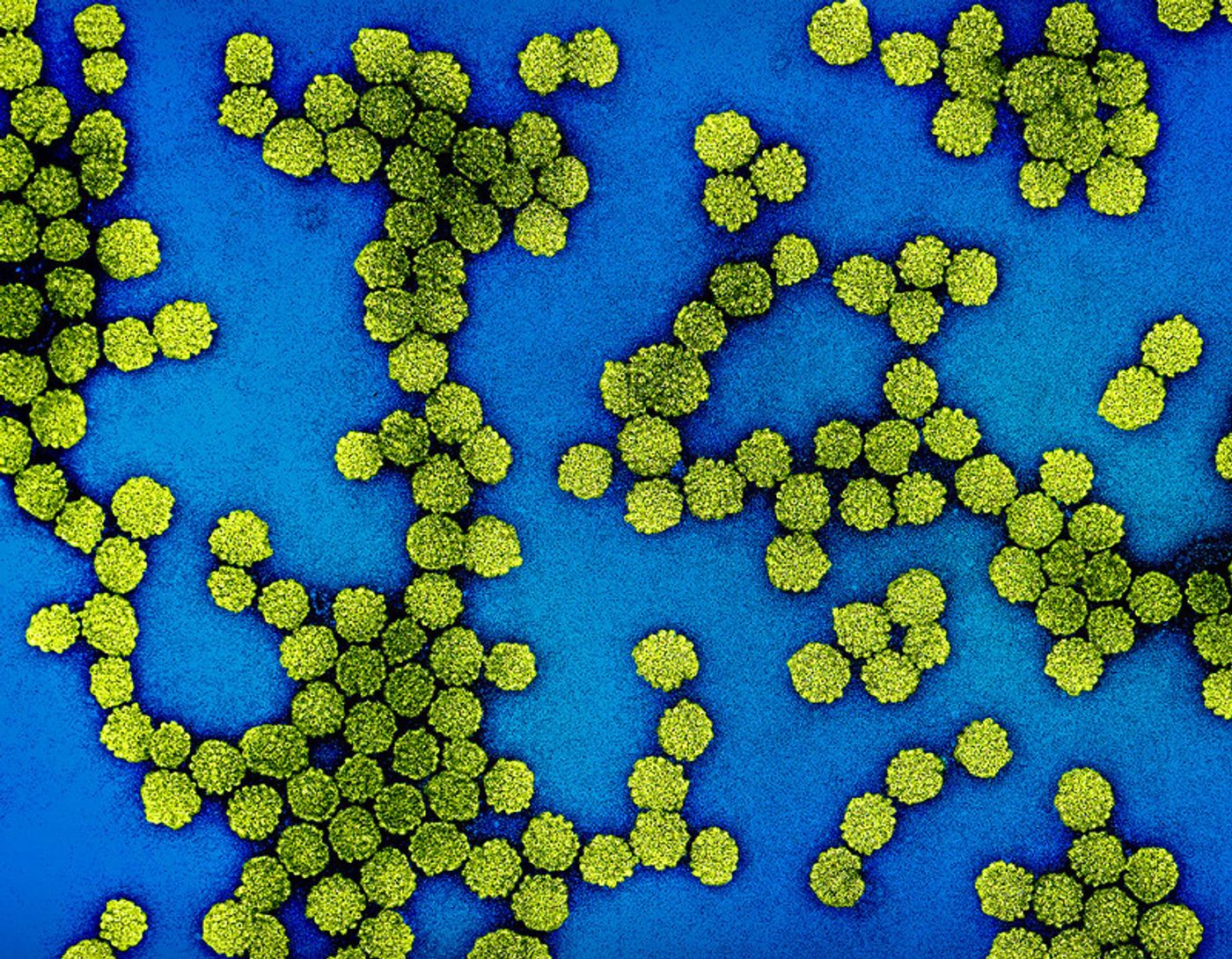 Colorized electron micrograph of HPV virus particles (yellow) harvested and purified from cell culture supernatant. Captured at the NIAID Integrated Research Facility (IRF) in Fort Detrick, Maryland. Credit: NIAID   