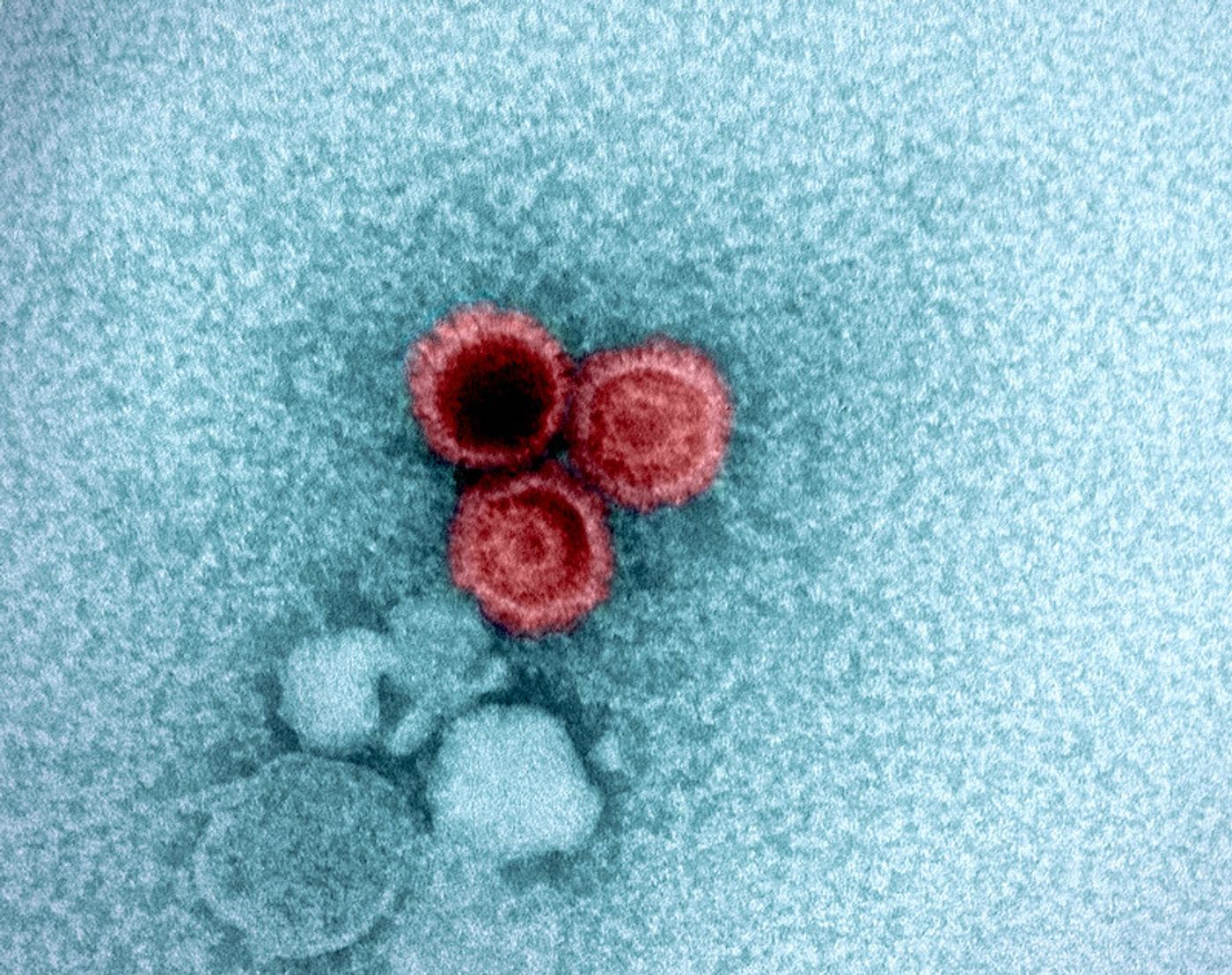 An electron micrograph showing three Epstein-Barr virus (EBV) particles colorized red. Credit: NIAID