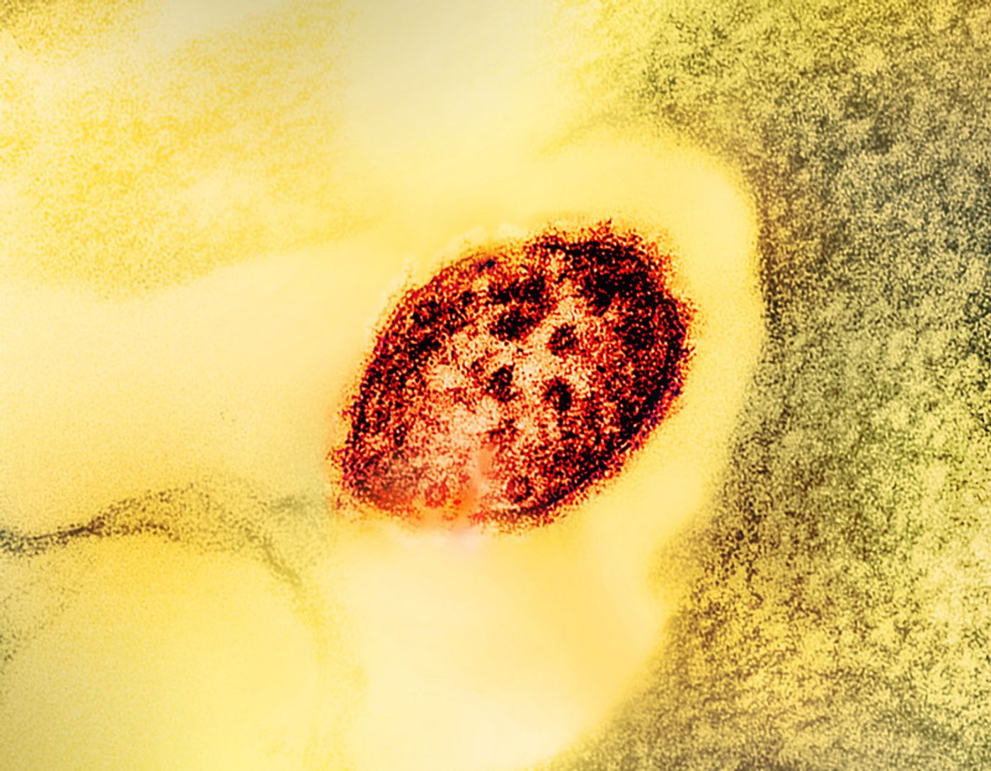 Colorized transmission electron micrograph of a measles virus particle (red). Credit: microscopy by CDC; layout, colorization and visual effects by NIAID. 