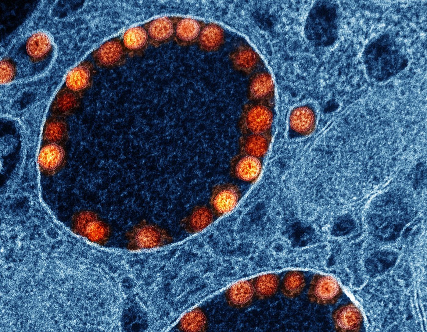 Transmission electron micrograph of SARS-CoV-2 virus particles (red/yellow) within endosomes of a heavily infected nasal olfactory epithelial cell. Image captured at the NIAID Integrated Research Facility (IRF) in Fort Detrick, Maryland. Credit: NIAID