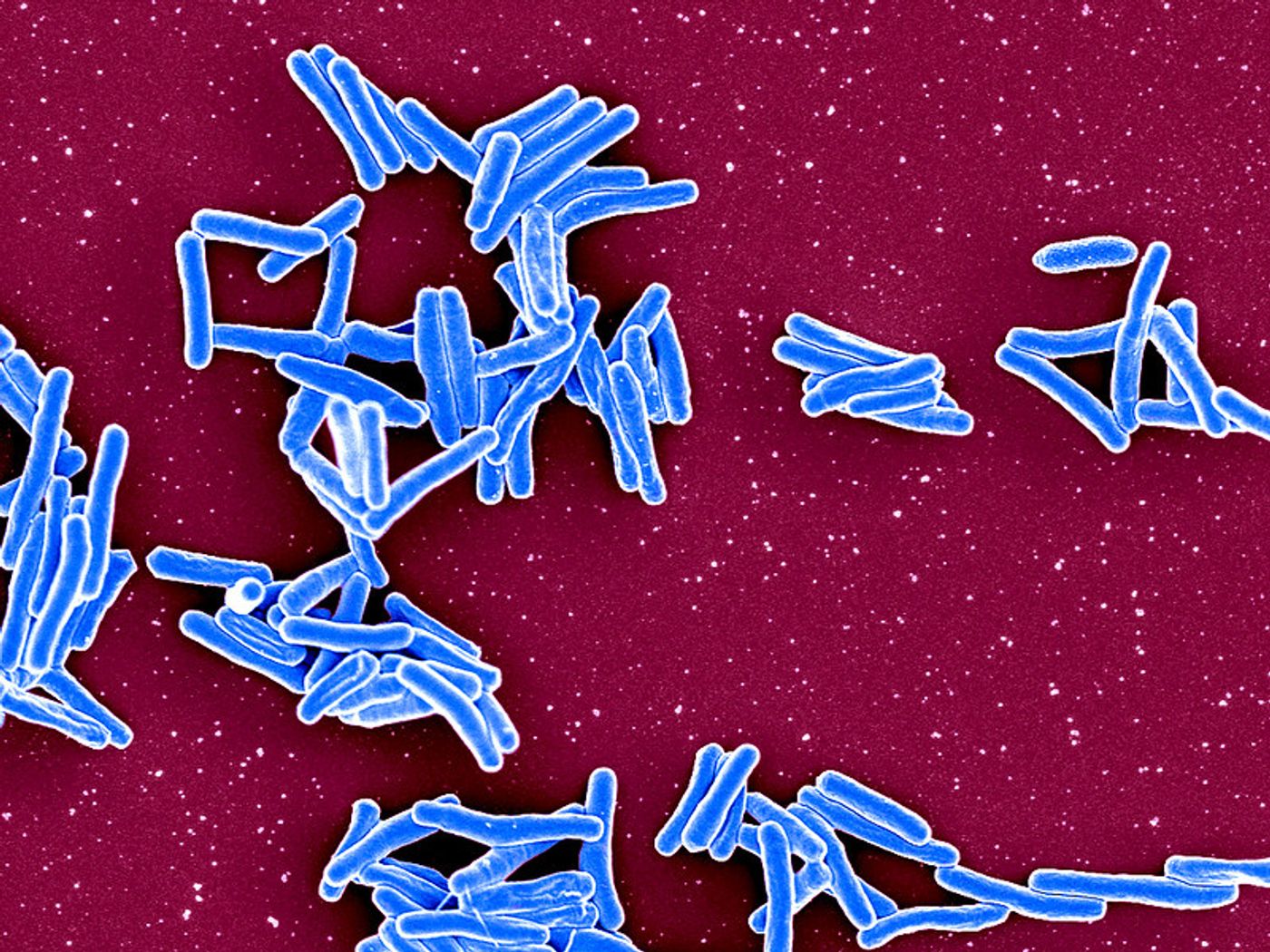 Mycobacterium Tuberculosis Bacteria  Scanning electron micrograph of Mycobacterium tuberculosis particles (colorized blue), the bacterium which causes TB. Credit: NIAID