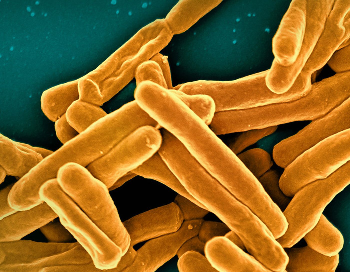 Scanning electron micrograph of Mycobacterium tuberculosis particles (colorized gold), the bacterium which causes TB. Credit: NIAID