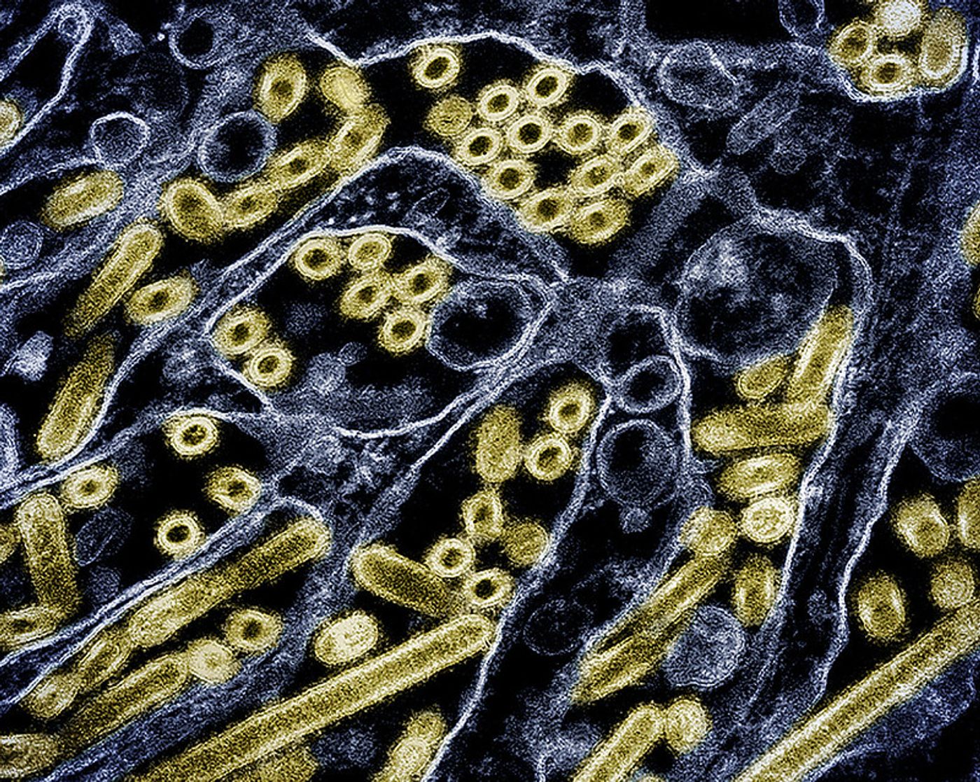 Colorized transmission electron micrograph of avian influenza A H5N1 virus particles (gold), grown in Madin-Darby Canine Kidney (MDCK) epithelial cells. Microscopy by CDC; repositioned and recolored by NIAID. Credit: CDC and NIAID 