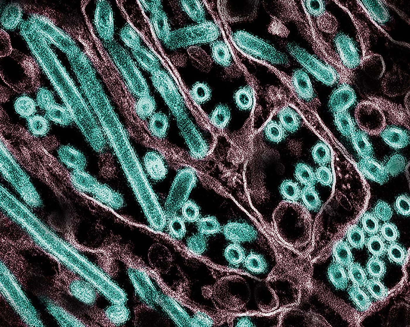   Colorized transmission electron micrograph of avian influenza A H5N1 virus particles (green), grown in Madin-Darby Canine Kidney (MDCK) epithelial cells. Microscopy by CDC; repositioned and recolored by NIAID. Credit: CDC and NIAID