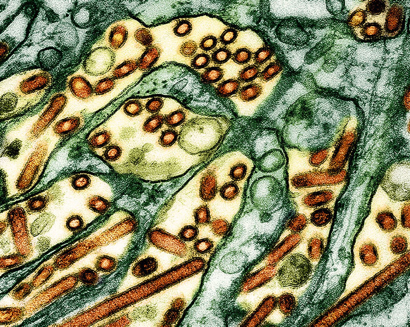 Colorized transmission electron micrograph of avian influenza A H5N1 virus particles (yellow/red), grown in Madin-Darby Canine Kidney (MDCK) epithelial cells. Microscopy by CDC; repositioned and recolored by NIAID. Credit: CDC and NIAID