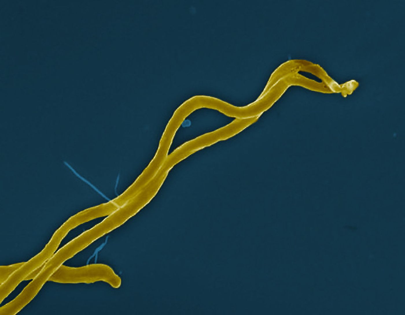 Borrelia burgdorferi bacteria (colorized gold), which can cause Lyme disease through the bite of an infected tick. Credit: NIAID 
