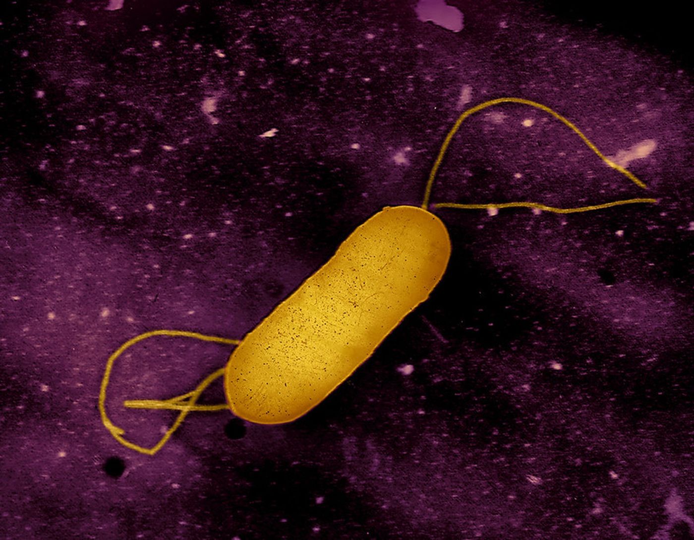 Colorized transmission electron micrograph of a flagellated Listeria bacterium. This pathogen causes the food borne illness listeriosis. Microscopy by CDC; colorization and visual effects by NIAID. Credit: CDC and NIAID