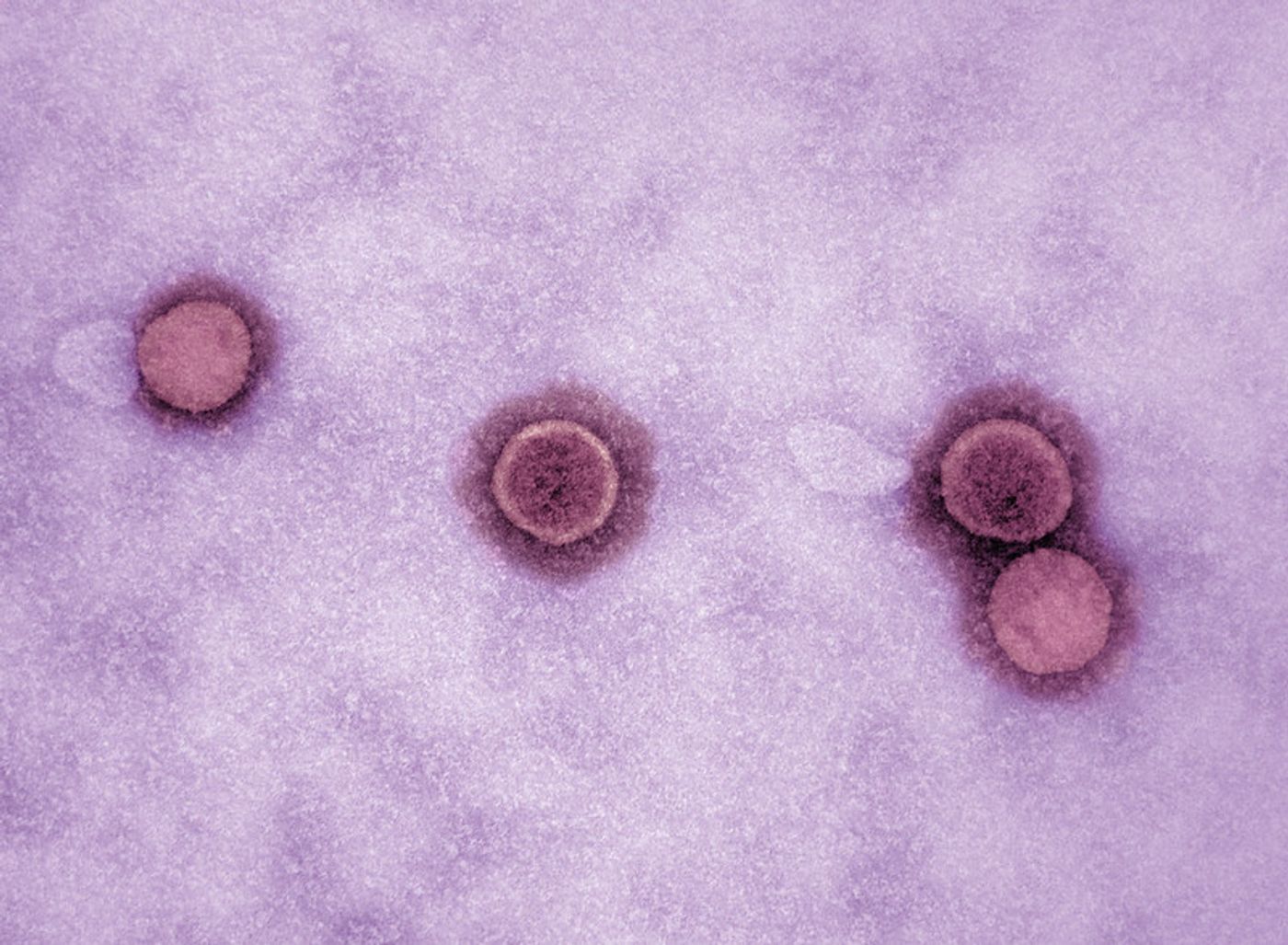 Colorized transmission electron micrograph of SARS-CoV-2 virus particles (pink), isolated from a patient. Image captured at the NIAID Integrated Research Facility (IRF) in Fort Detrick, Maryland. Credit: NIAID