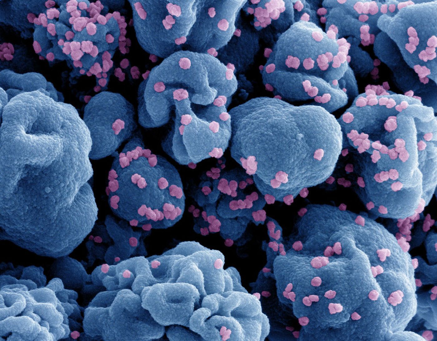 Colorized scanning electron micrograph of a cell (blue) infected with SARS-CoV-2 virus particles (pink), isolated from a patient sample. Image captured at the NIAID Integrated Research Facility (IRF) in Fort Detrick, Maryland. / Credit: NIAID