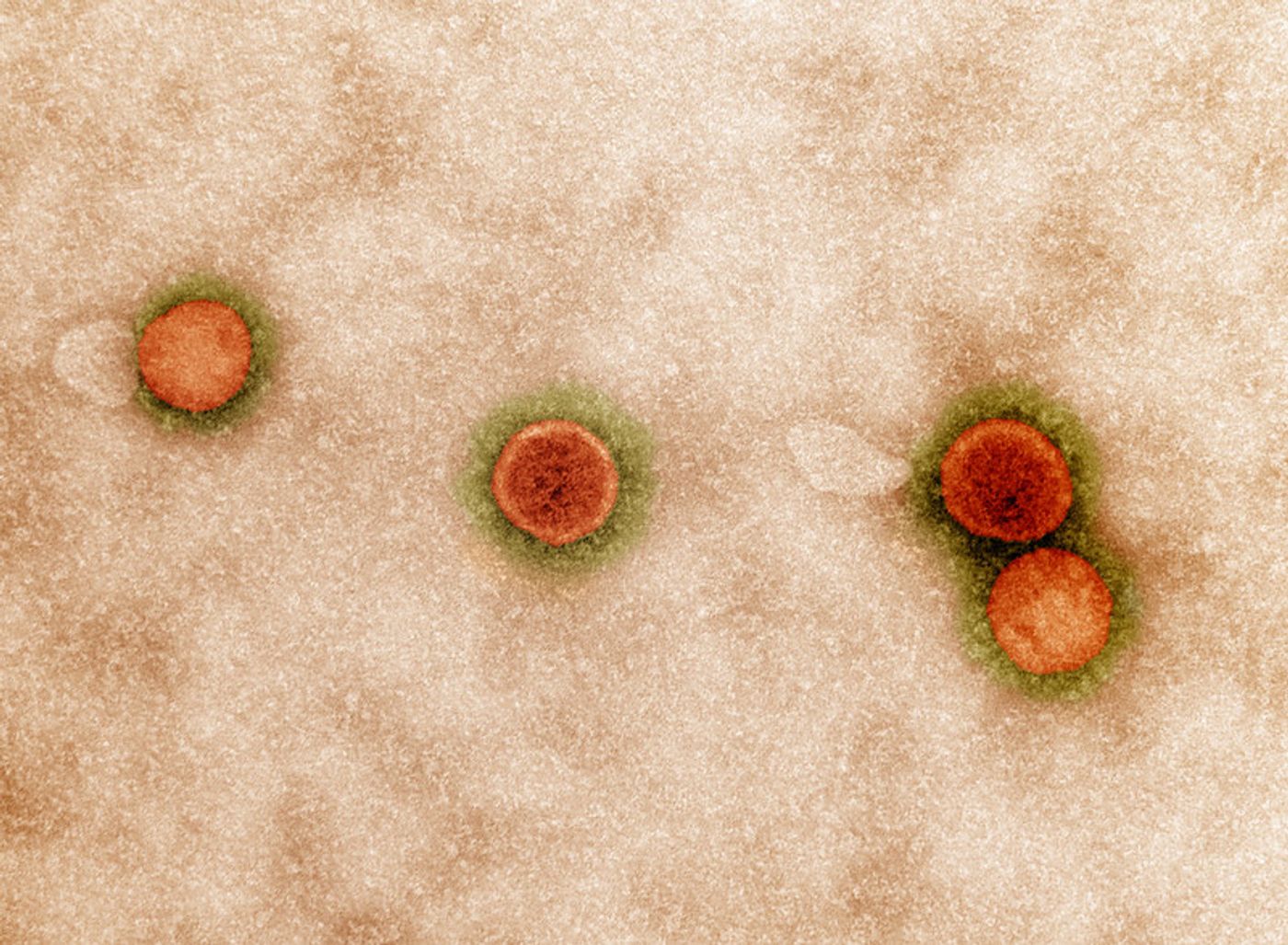 Colorized transmission electron micrograph of SARS-CoV-2 virus particles, isolated from a patient. Image captured at the NIAID Integrated Research Facility (IRF) in Fort Detrick, Maryland. Credit: NIAID