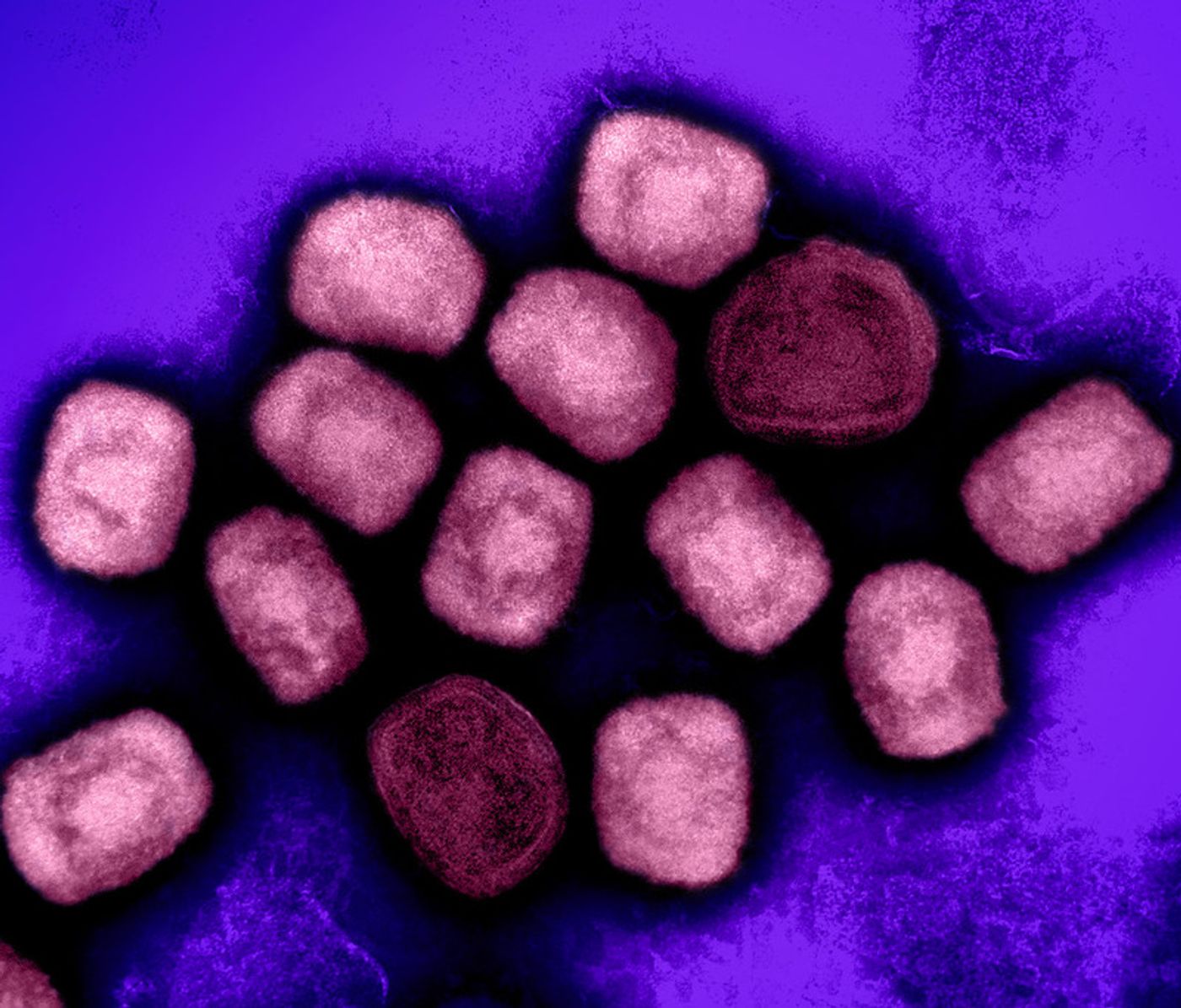 Colorized transmission electron micrograph of mpox virus particles (pink) cultivated and purified from cell culture. Image captured at the NIAID Integrated Research Facility (IRF) in Fort Detrick, Maryland. Credit: NIAID