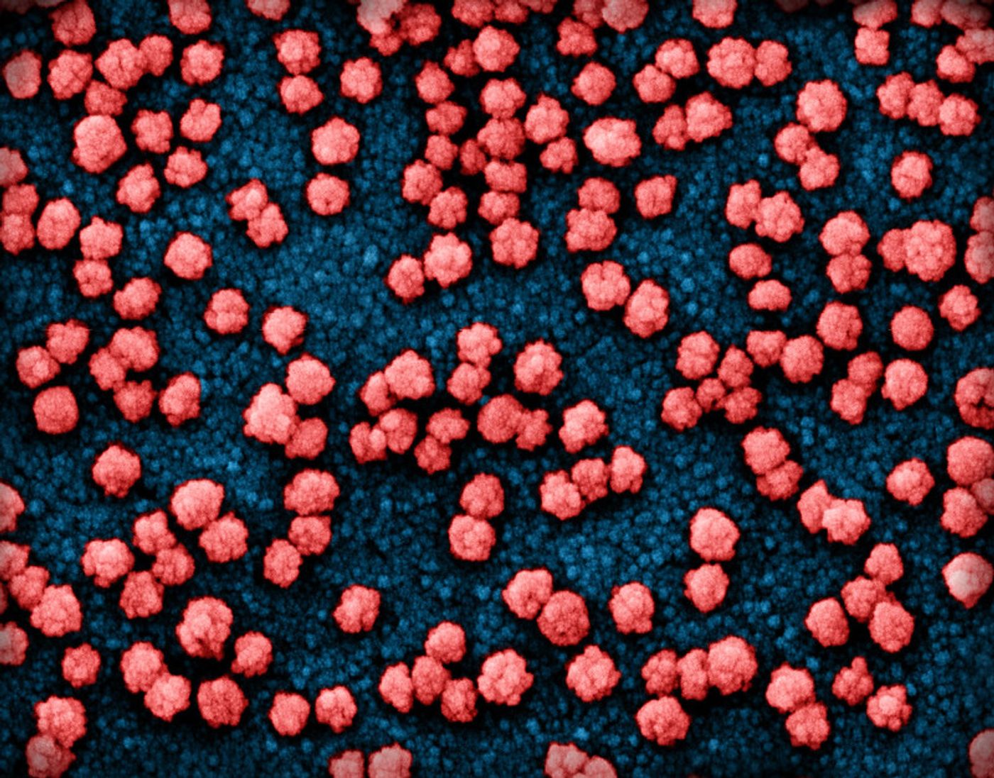 Colorized scanning electron micrograph of SARS-COV-2 particles (red) on and budding from the surface of a heavily infected VERO E6 cell (blue). Image captured at the NIAID Integrated Research Facility (IRF) in Fort Detrick, Maryland. Credit: NIAID