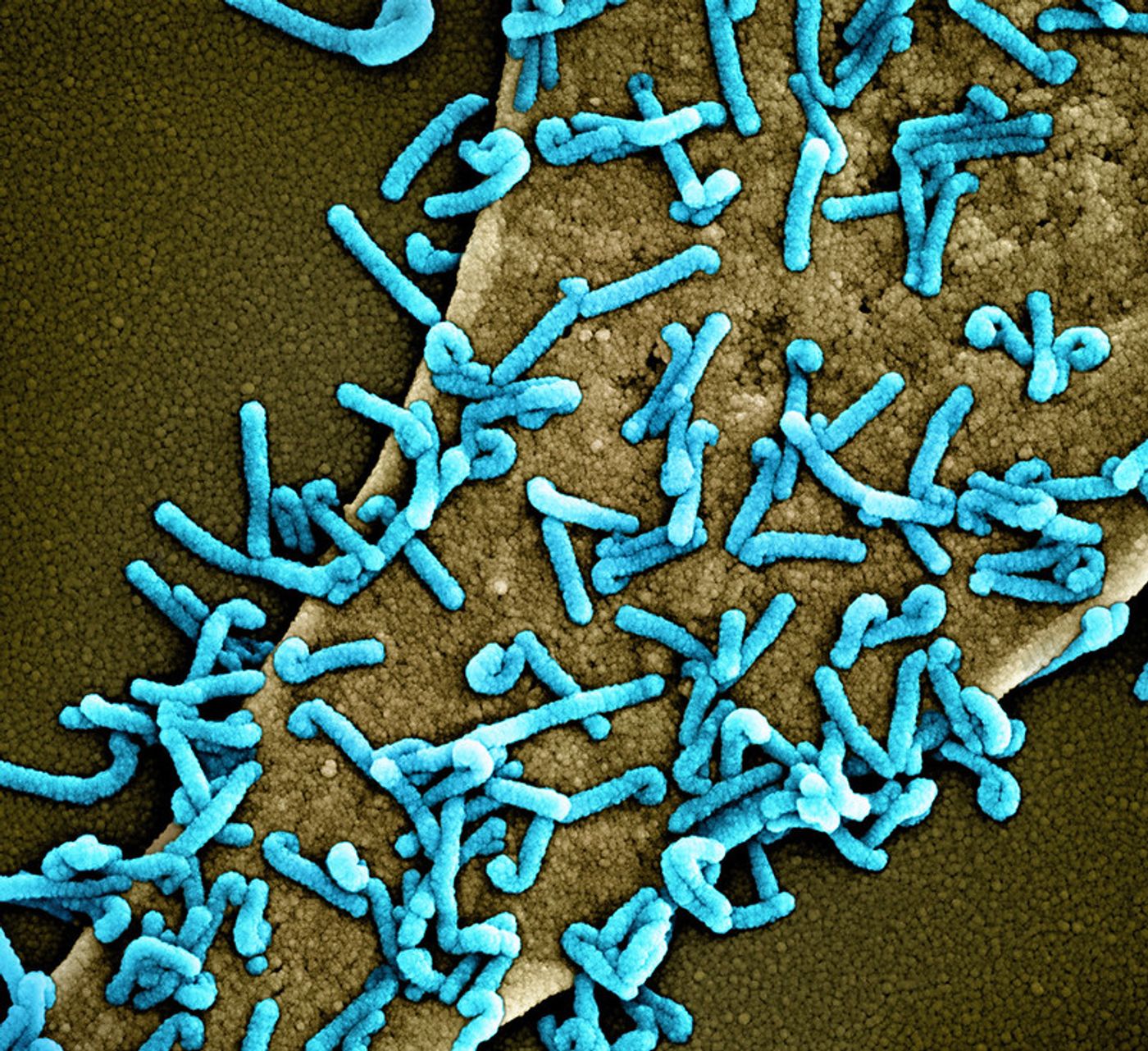 Colorized scanning electron micrograph of Marburg virus particles (teal) both budding and attached to the surface of an infected VERO E6 cell (tan). Image captured at the NIAID Integrated Research Facility in Fort Detrick, Maryland. Credit: NIAID