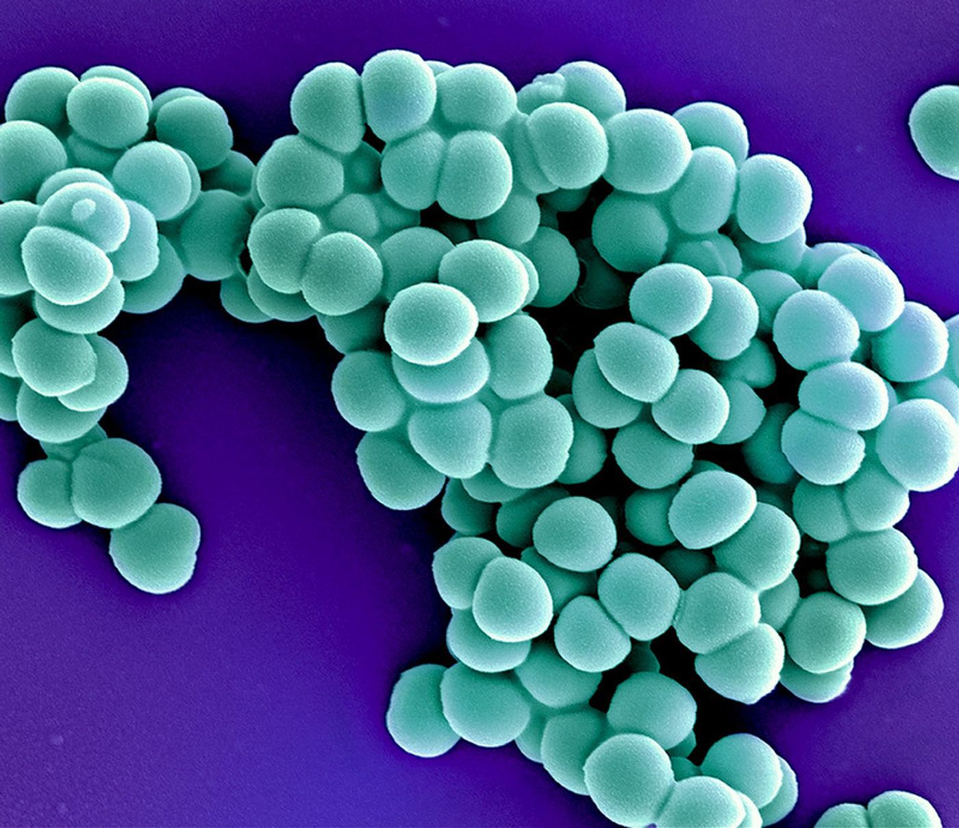 Colorized scanning electron micrograph of Methicillin-resistant Staphylococcus aureus (MRSA) bacteria (teal). Captured at the NIAID Integrated Research Facility (IRF) in Fort Detrick, Maryland. Credit: NIAID