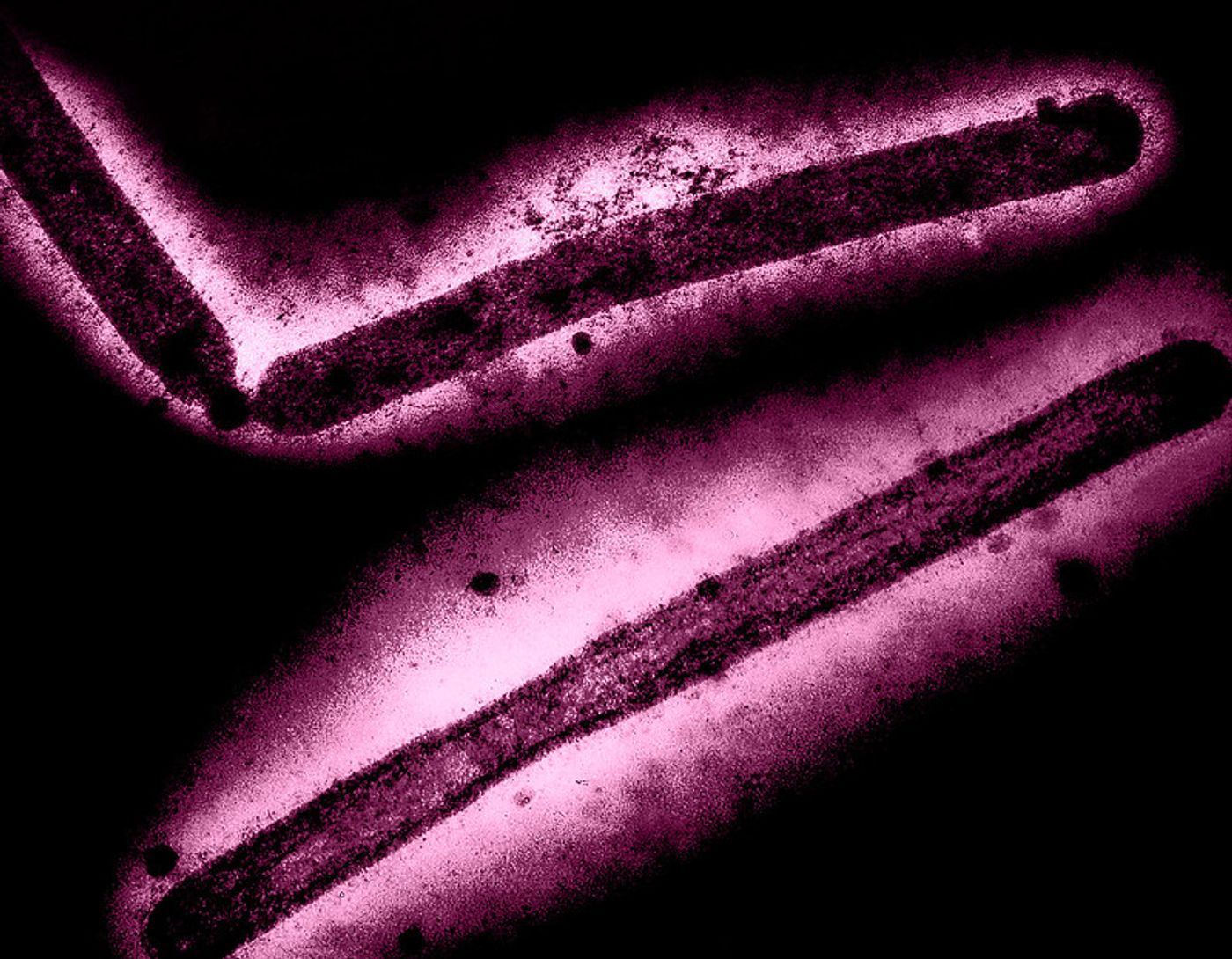 Influenza A (H5N1/bird flu) virus particles (rod-shaped). Layout incorporates two CDC transmission electron micrographs that have been inverted and creatively repositioned and colorized by NIAID. Scales have been modified. Credit: CDC and NIAID