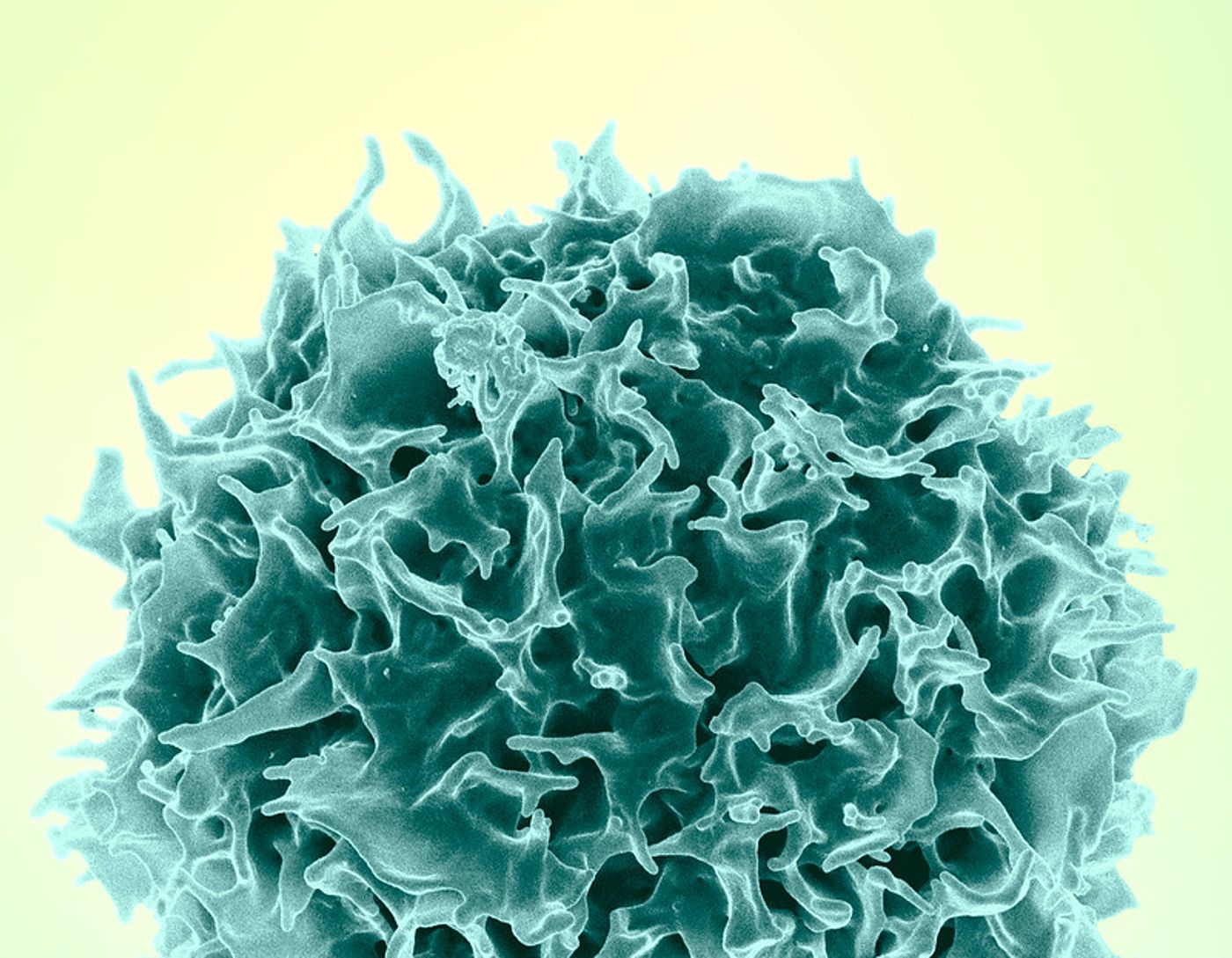 Colorized scanning electron micrograph of a healthy T lymphocyte (teal), also known as a T cell. / Credit: NIAID