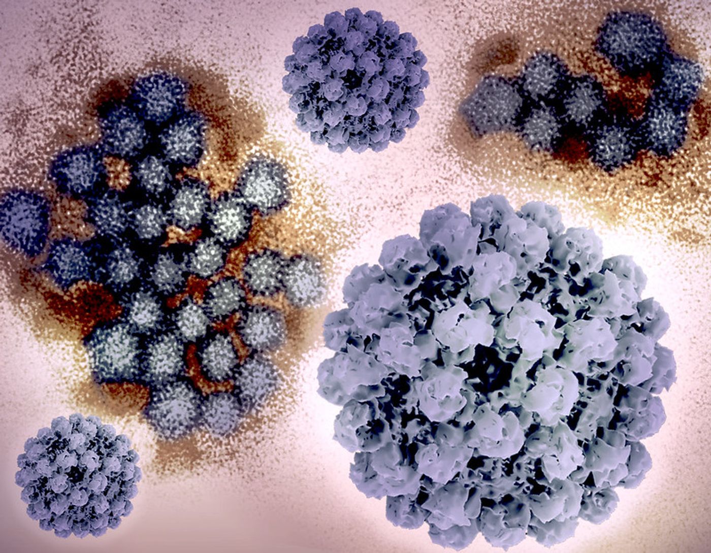 Creative layout featuring 3D renderings of norovirus structures, generated from electron microscopy (top center and bottom left and right), and a transmission electron micrograph of norovirus particles in the background. 3D renderings of norovirus VLPs by NIH 3D (3dprint.nih.gov); transmission electron micrograph-which has been repositioned and colored by NIAID-is courtesy of CDC. Note: not to scale. Credit: NIAID and CDC