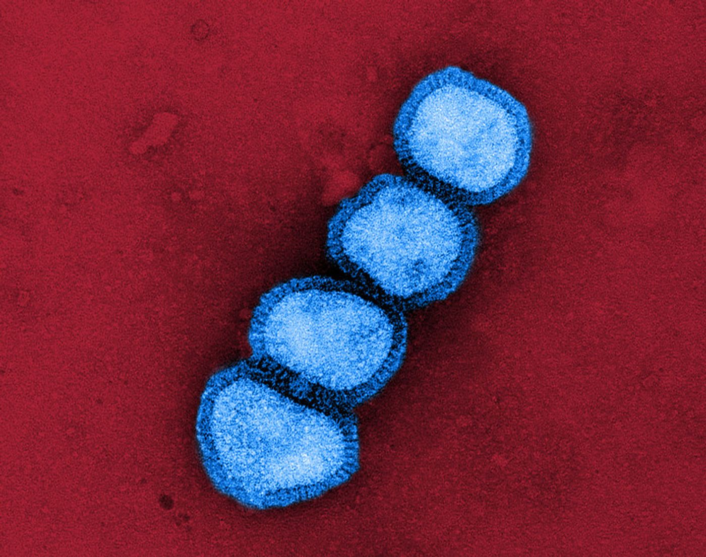   Colorized transmission electron micrograph of influenza A/H1N1 virus particles (blue). Influenza A/H1N1 can infect both humans and animals, including birds and pigs, and is one of several strains related to seasonal flu outbreaks. Microscopy by John Gallagher and Audray Harris, NIAID Laboratory of Infectious Diseases.     Credit: NIAID/NIH