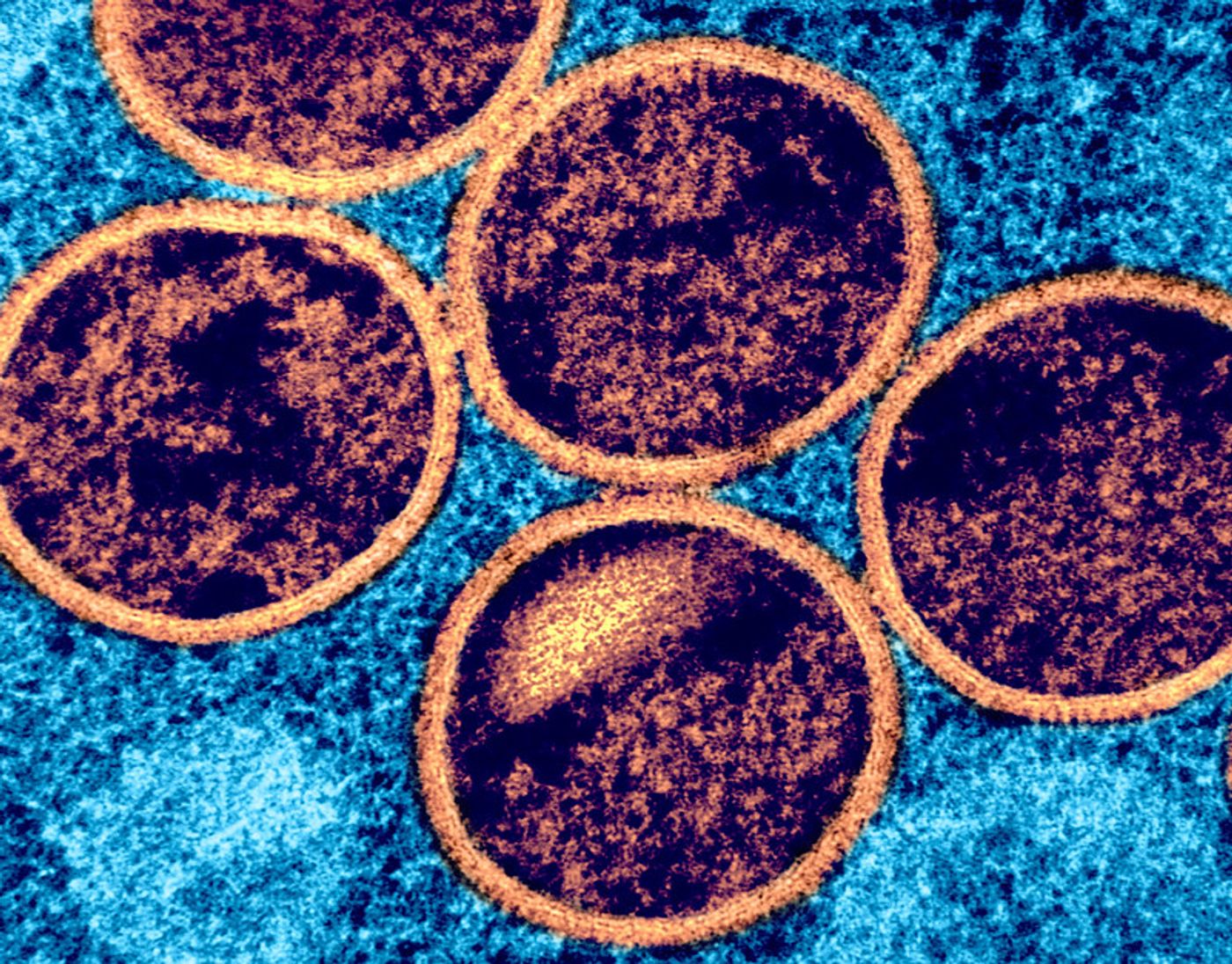 Colorized transmission electron micrograph of immature mpox virus particles (purple/orange with orange viral envelope) found within an infected VERO E6 cell (blue), cultured in the laboratory. Image captured at the NIAID Integrated Research Facility (IRF) in Fort Detrick, Maryland. Credit: NIAID