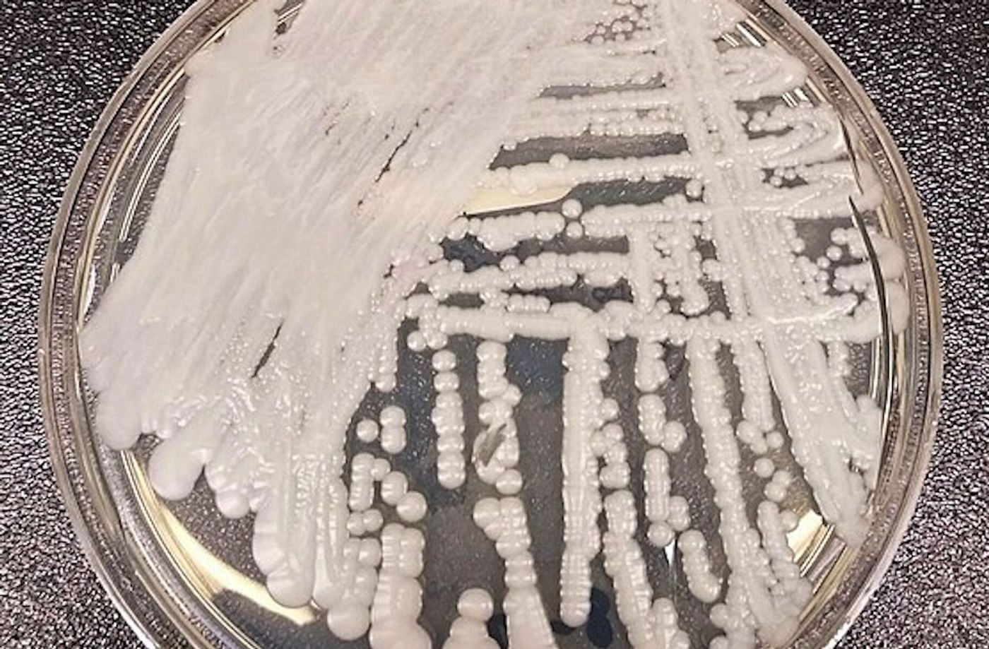 A strain of Candida auris cultured in a petri dish at a CDC laboratory. / Credit: CDC