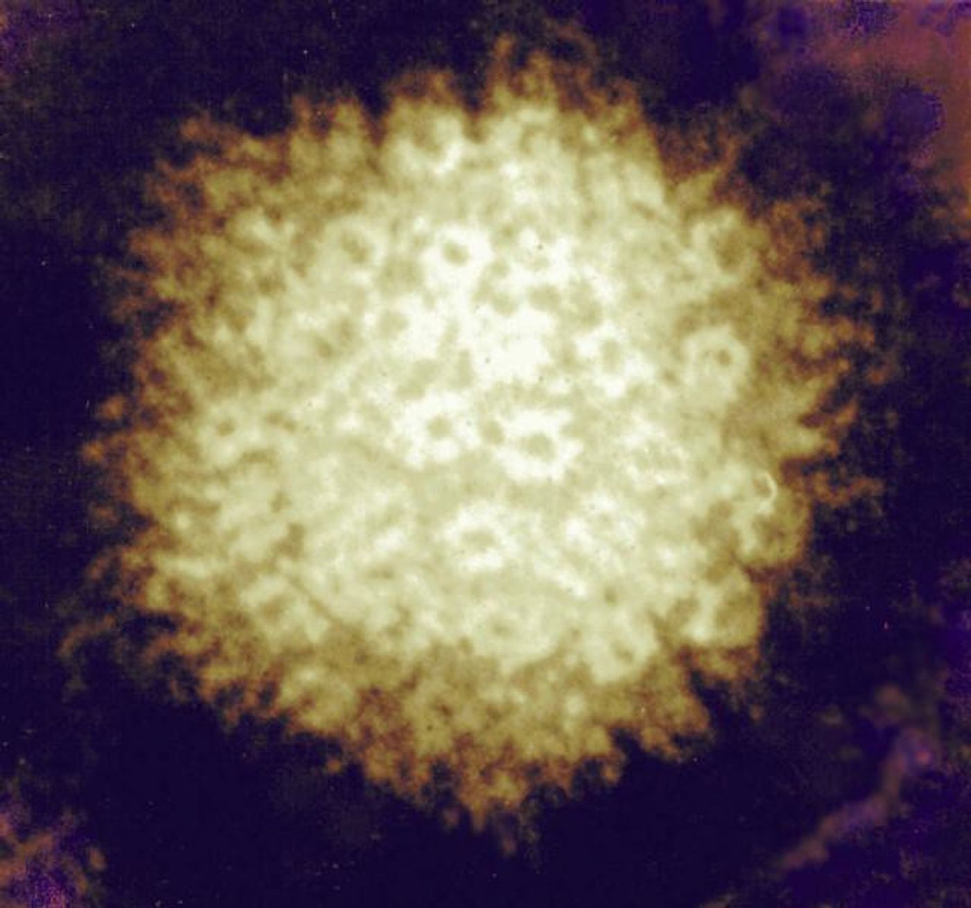 Varicella-zoster Virus  Firey-looking electron micrograph of herpes simplex virus. Credit: NIAID