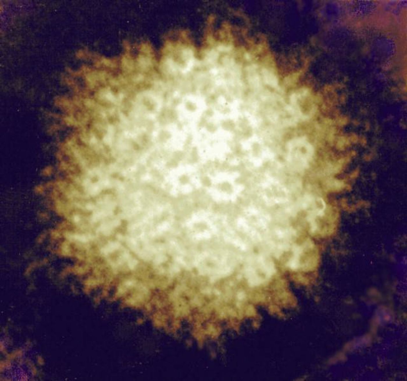 Varicella-zoster Virus  Firey-looking electron micrograph of herpes simplex virus. Credit: NIAID