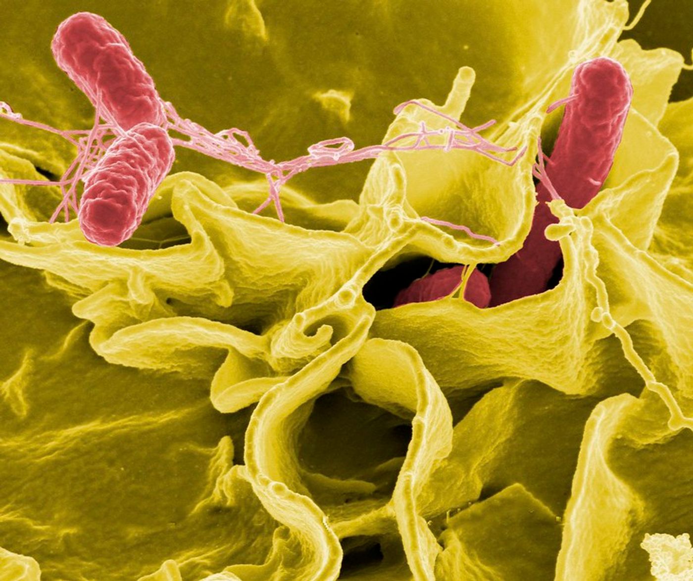 Salmonella bacteria (pink), a common cause of foodborne disease, invade a human epithelial cell (yellow). Credit: NIAID