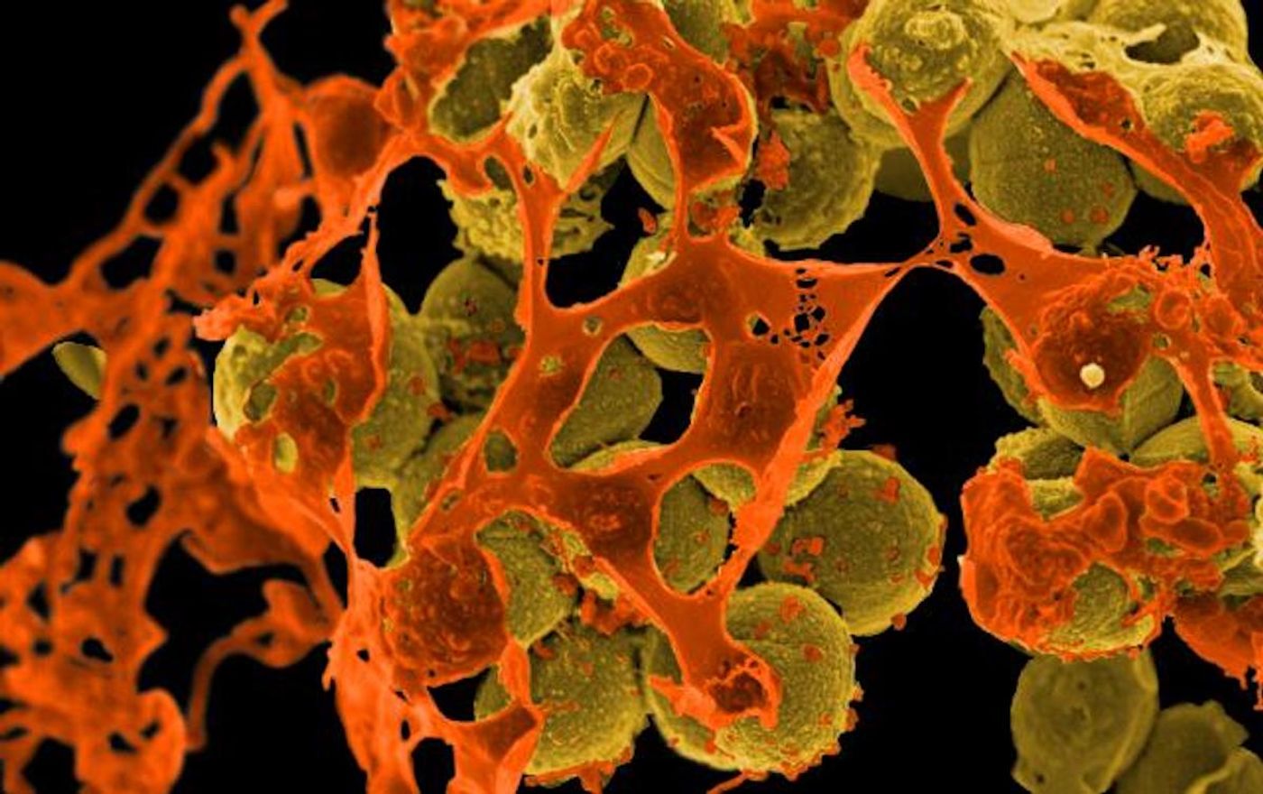 Methicillin-Resistant Staphylococcus aureus (MRSA) Bacteria  Scanning electron micrograph of methicillin-resistant Staphylococcus aureus (MRSA, yellow) surrounded by cellular debris. / Credit: NIAID
