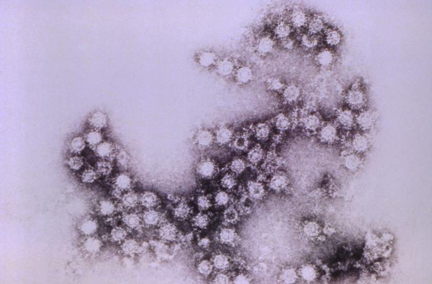 A non-polio enterovirus /  Credit: CDC