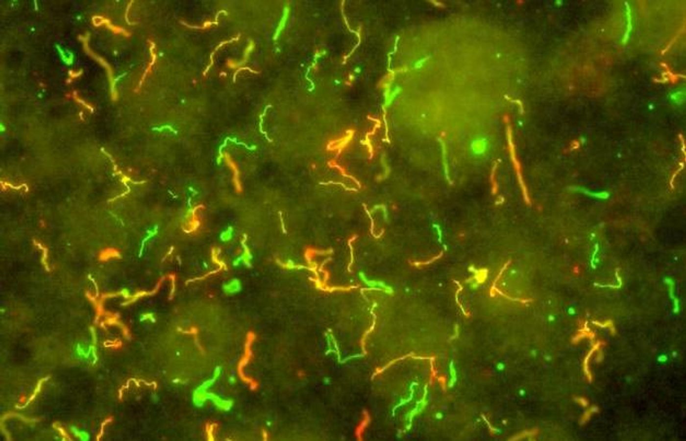 Borrelia burgdorferi is a parasite that cycles between ticks and vertebrate hosts. In this merge, an image of outer surface protein D (yellow and red) is overlaid with an image of anti-B. burgdorferi antibody (green). Image credit: NIAID