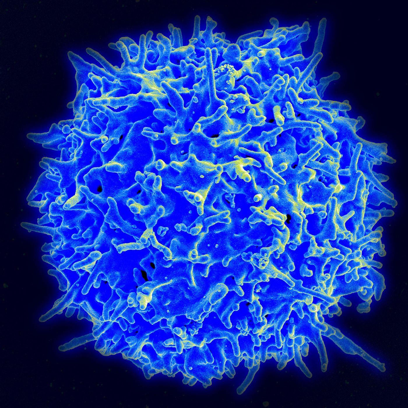 Scanning electron micrograph of a T cell. Credit: NIAID