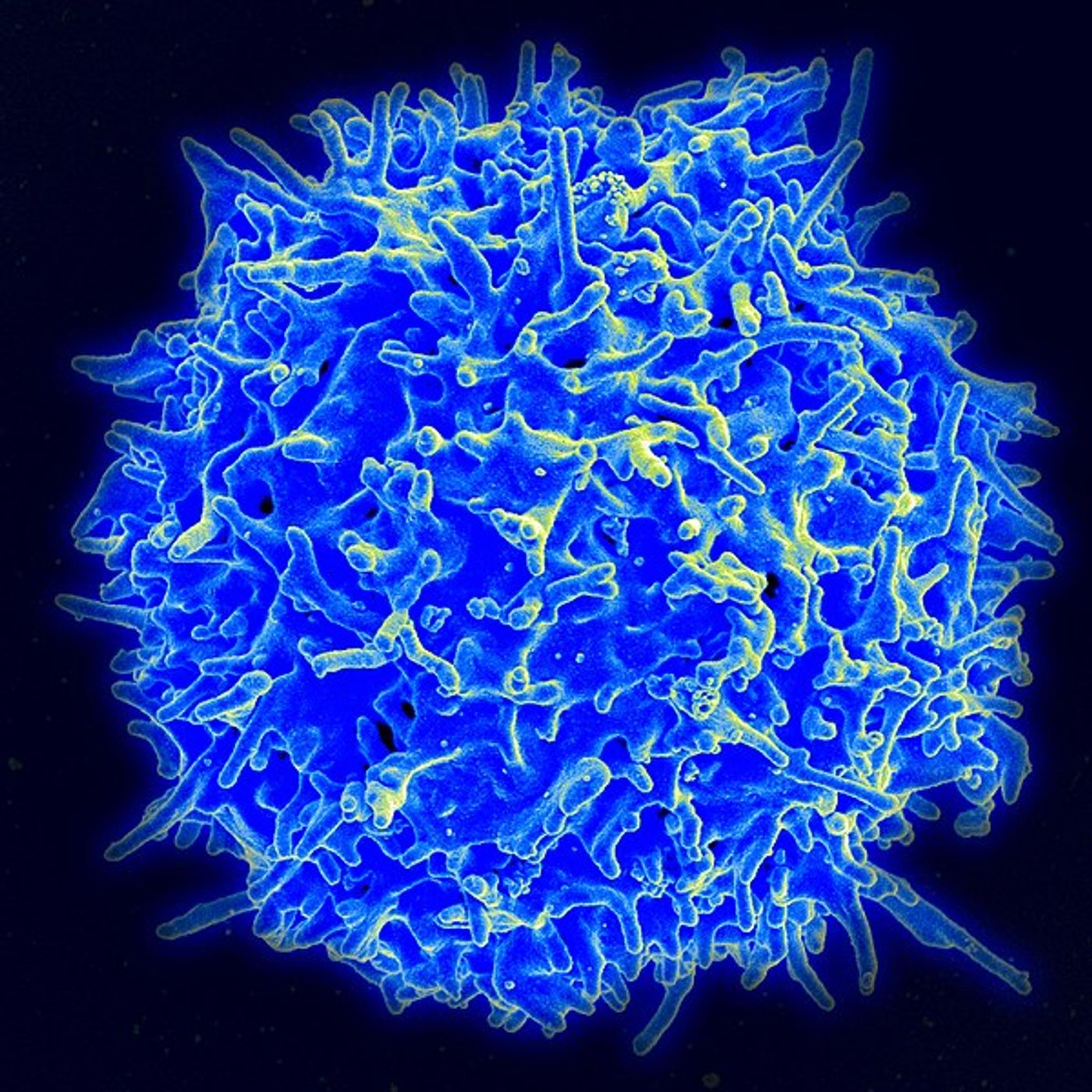 Scanning electron micrograph of a human T lymphocyte. Credit: NIAID