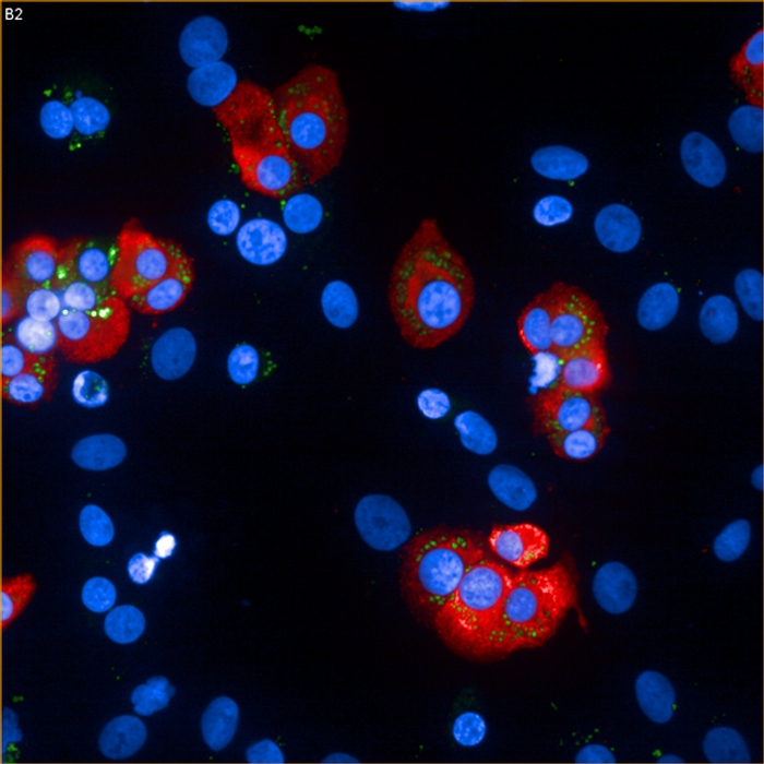 Human beta cells and insulin granules. Credit: Wikimedia user Wikimaji