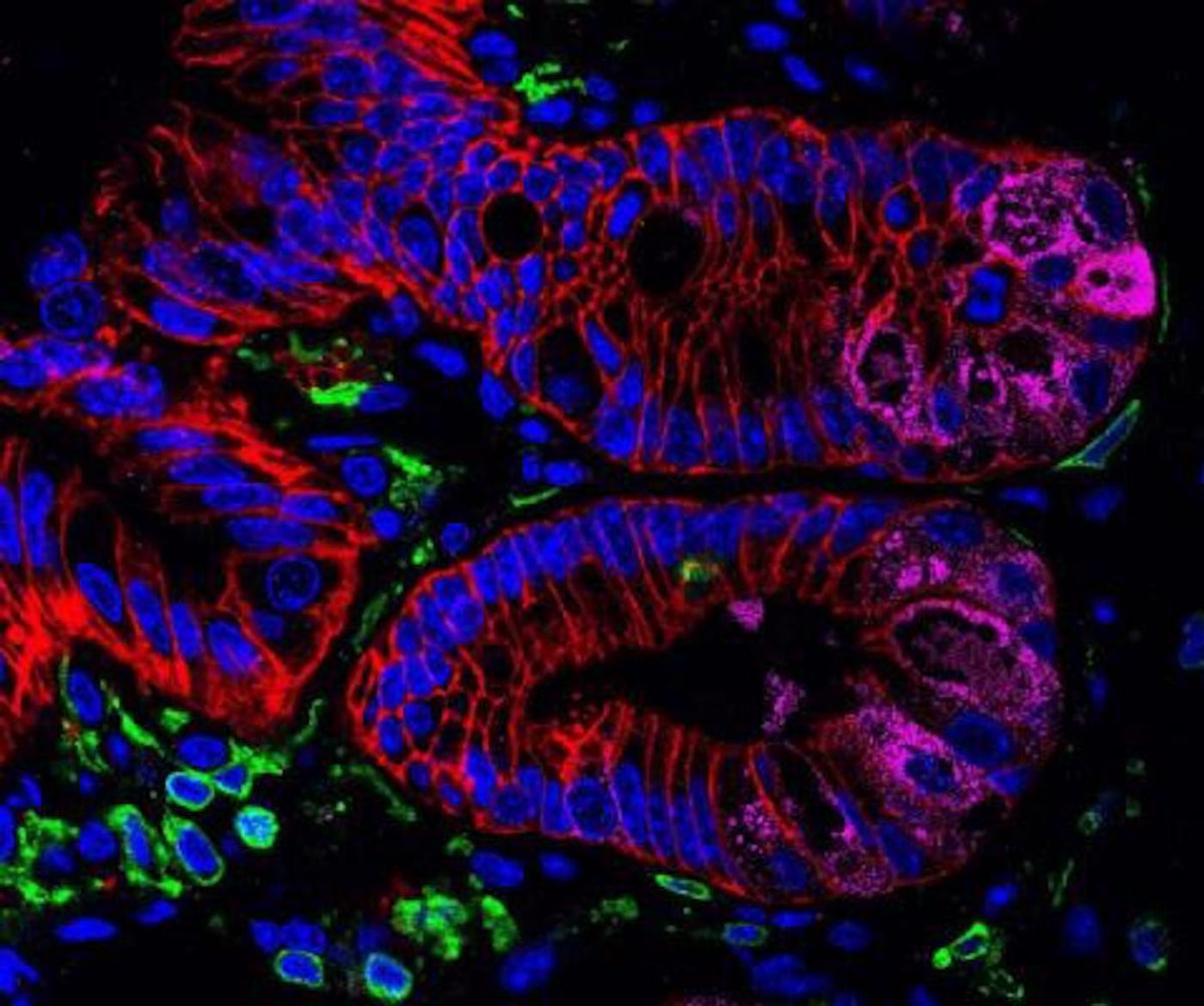 This image shows a histologic section of intestinal tissue isolated from healthy mice stained to visualize intestinal epithelial cells/ Credit: Lance Peterson, Theresa Alenghat, and David Artis. Perelman School of Medicine, University of Pennsylvania.