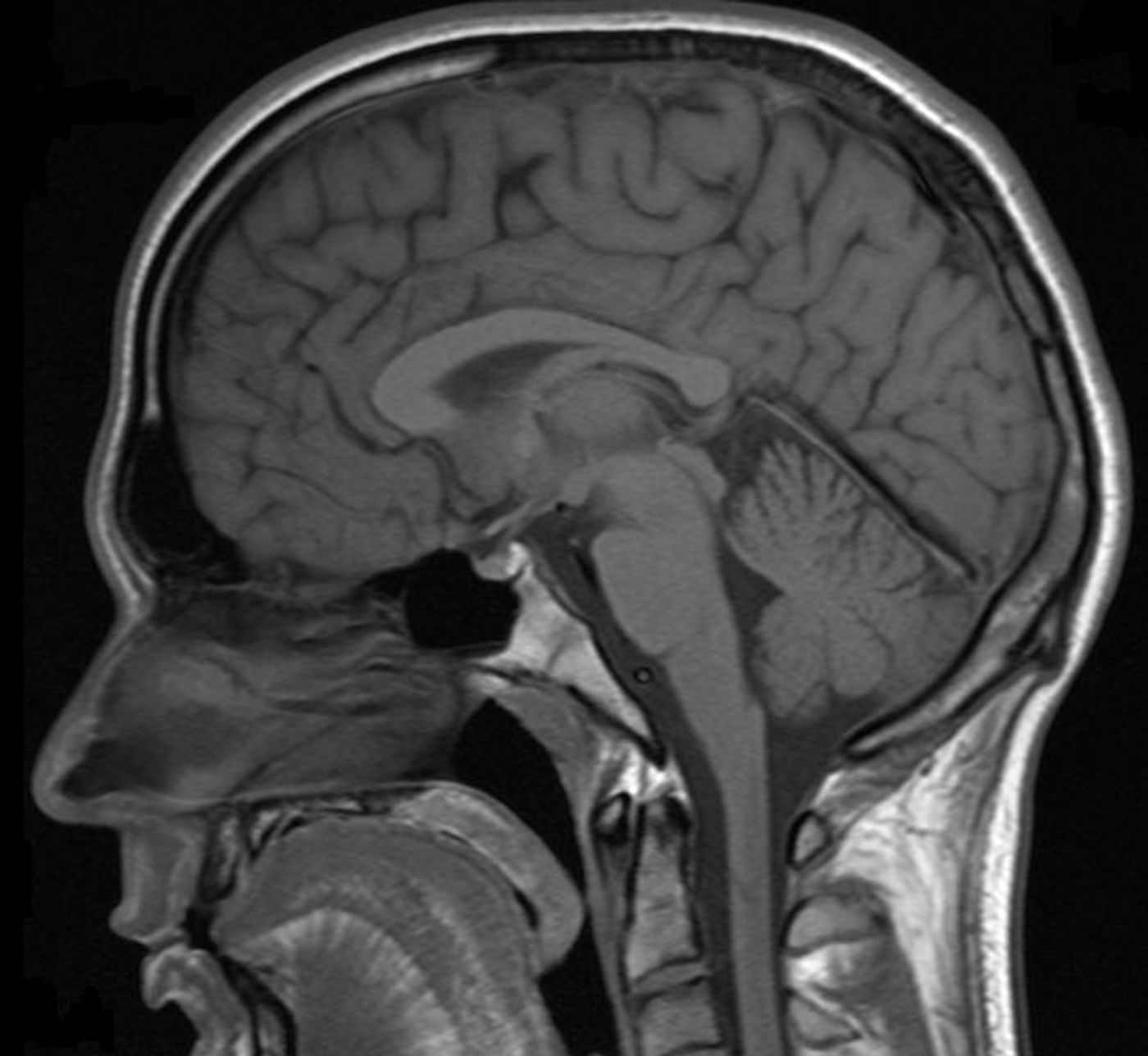 MRI scan of a human head. Credit: Helmut Januschka
