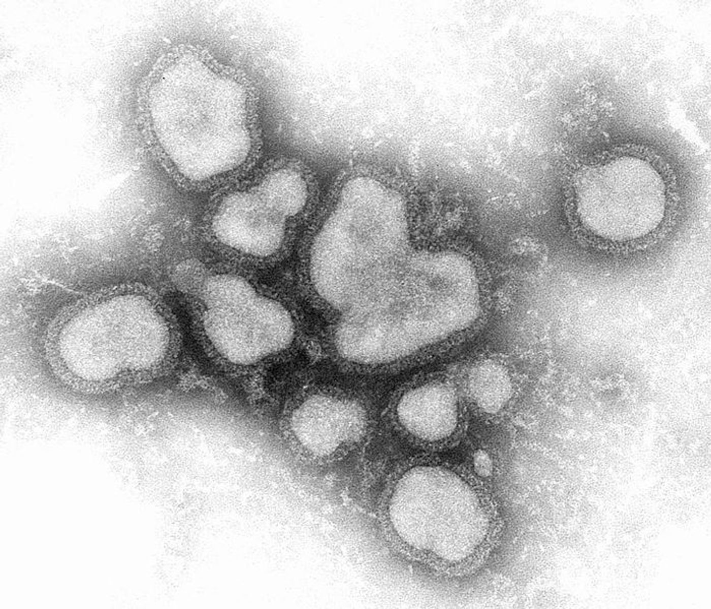 A transmission electron micrograph, negative stain image of the influenza A virus. Credit: CDC