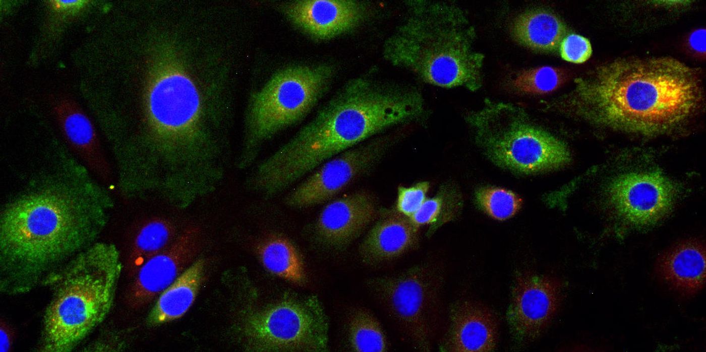 Making insights into how virus-infected cells can survive the onslaught of an immune response, researchers have found that cells enriched with defective viral genomes (in green) had strategies to persist, unlike cells with more full-length viral genomes (in orange/yellow). Credit: University of Pennsylvania