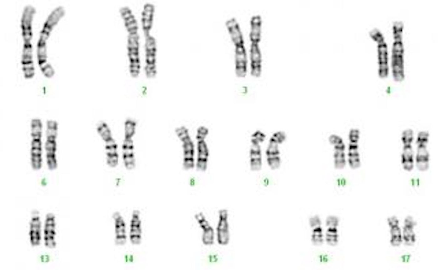 A portion of an image of a karyotype / Credit: ©UNIGE - S. Antonarakis' lab