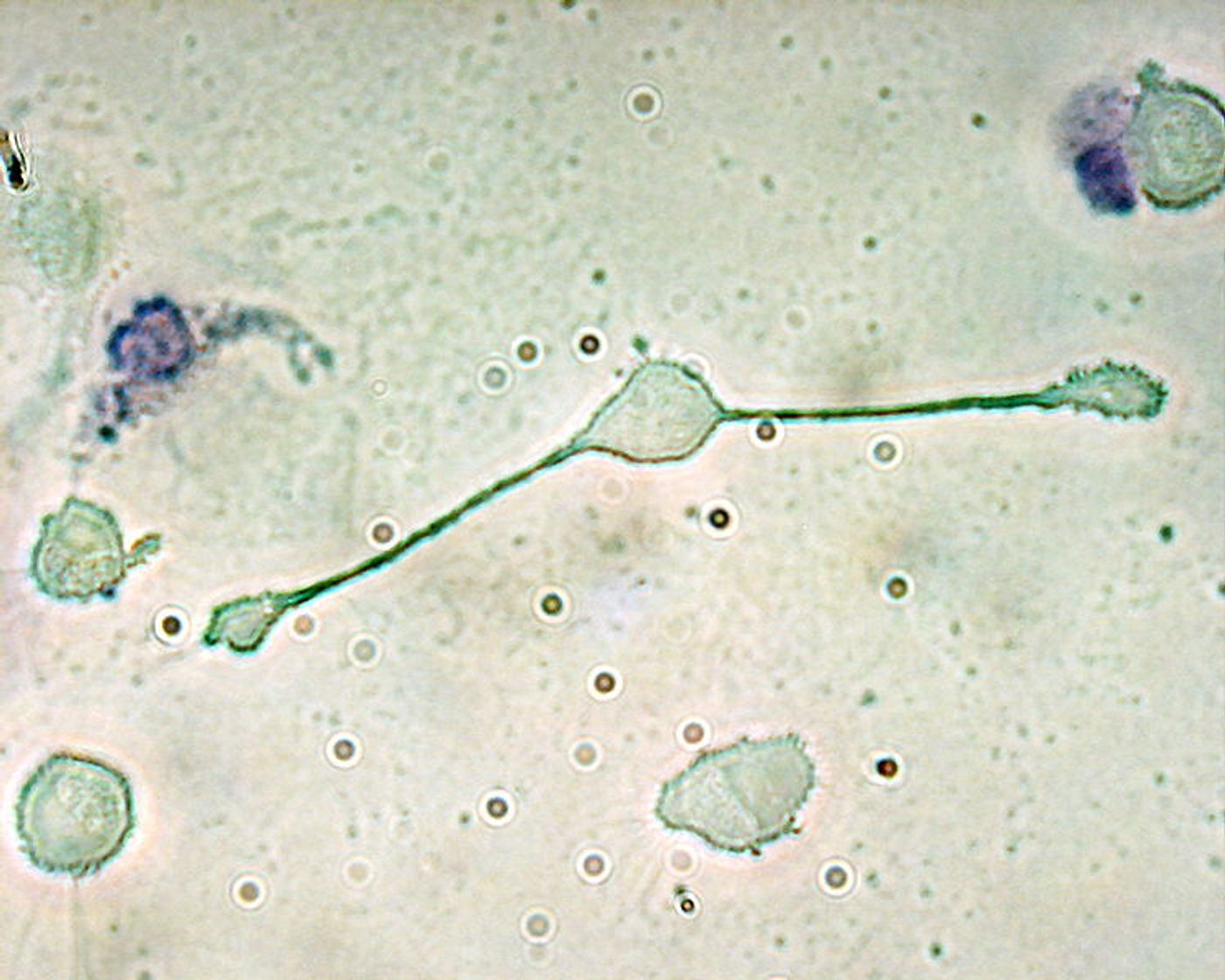 A macrophage of a mouse forming two processes to phagocytize two smaller particles, possibly pathogens. Credit: Wikimedia user magnaram