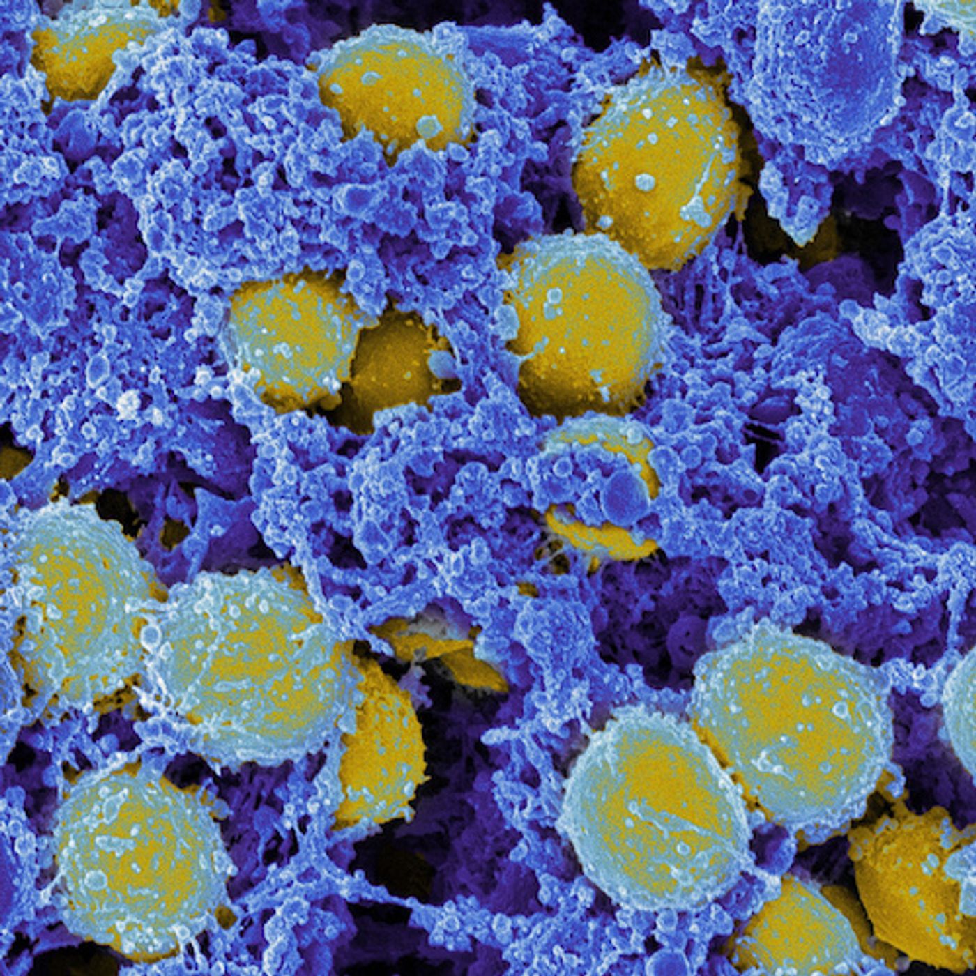 Scanning electromicrograph of Staphylococcus aureus bacteria. Credit: NIAID