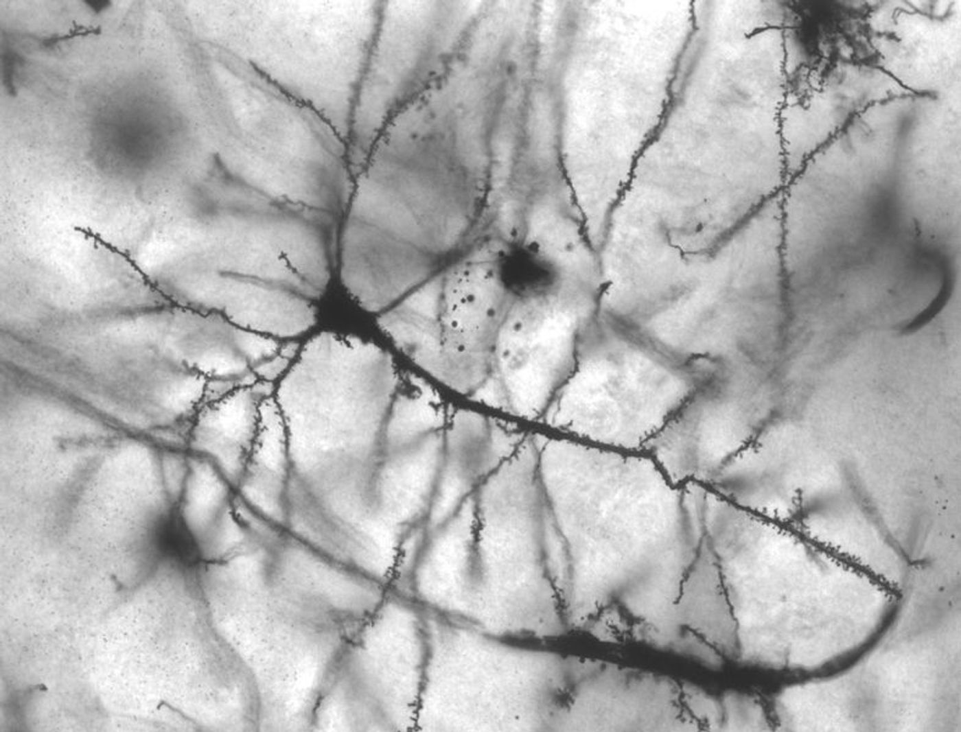 Golgi stained pyramidal neuron in the hippocampus of an epileptic patient. Credit: MethoxyRoxy