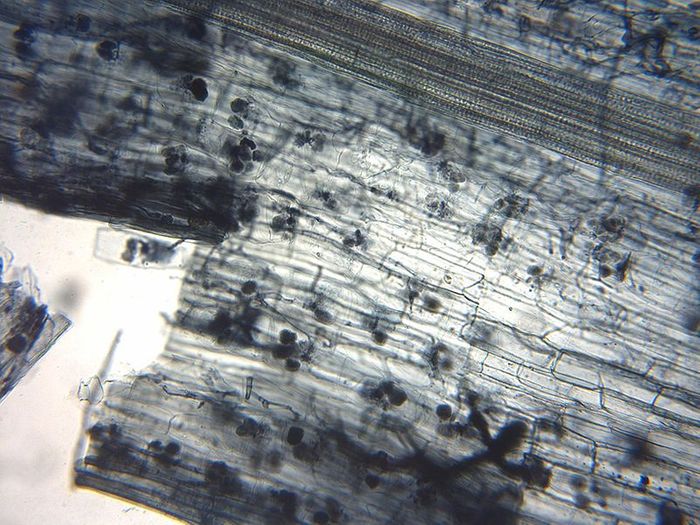 Arbuscular Mycorrhizal Fungi under a microscope.