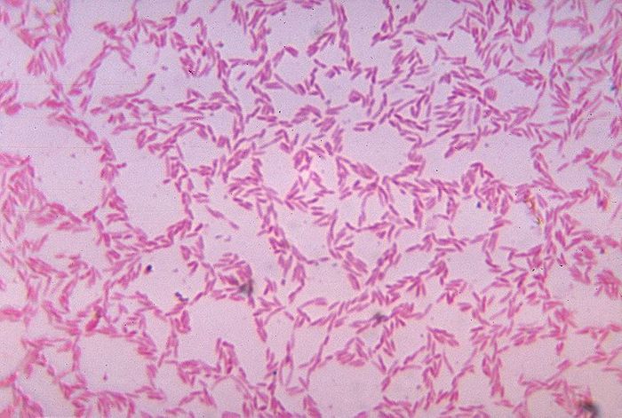 Bacteroides biacutis, one of many commensal anaerobic Bacteroides secies in the gastrointestinal tract. Credit: CDC
