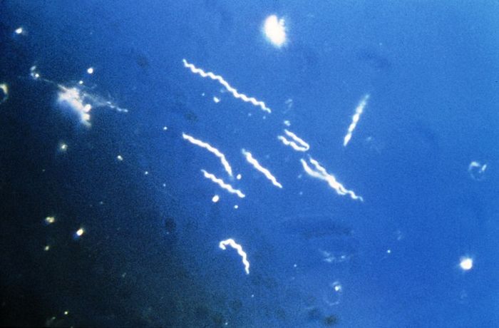 This photomicrograph reveals the presence of the spirochaete bacteria known as Borrelia burgdorferi, which is the pathogen that causes Lyme disease. Credit: CDC Public Health Image Library